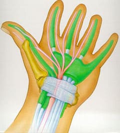 carpel tunnel image