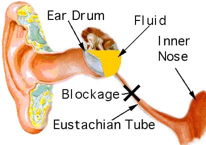 ear diagram image